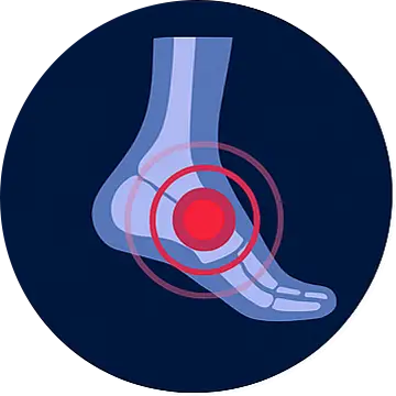 lIlustration von Fuss mit Scherzpunkt