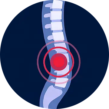 Wirbelsäule - Rückenschmerzen